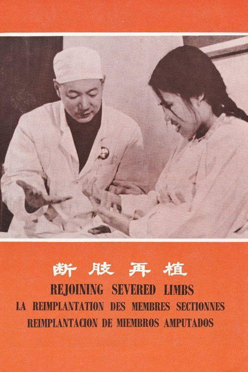 断肢再植